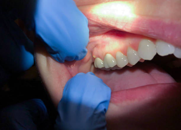 Best Urgent Care for Lost Fillings or Crowns in Hutchinson, KS